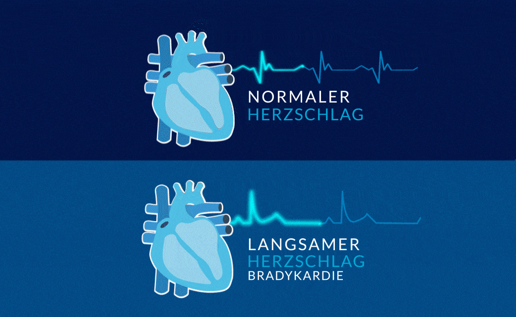 Video, das einen langsamen Herzrhythmus simuliert. Hören sie auf ihr herz